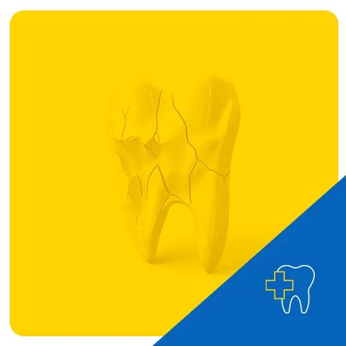 3D illustration of a cracked molar on a yellow background, symbolizing dental trauma.