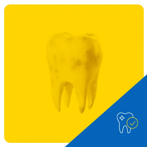 3D graphic of a molar tooth with visible stains on a vibrant yellow background, highlighting dental discoloration.