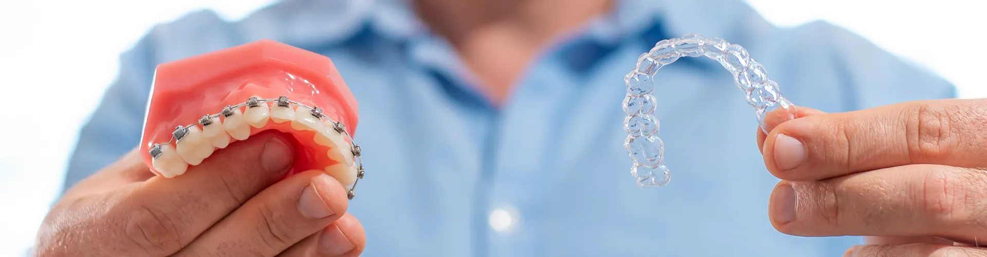 man holding braces model in one hand and clear aligner in the other hand