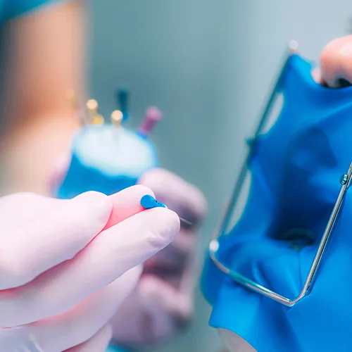 gloved hands holding dental tools by patient's mouth