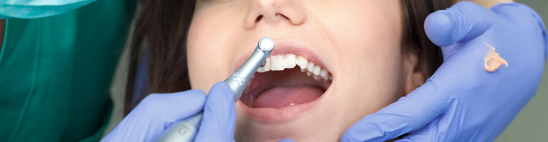 gloved hands using dental tool to clean woman's teeth